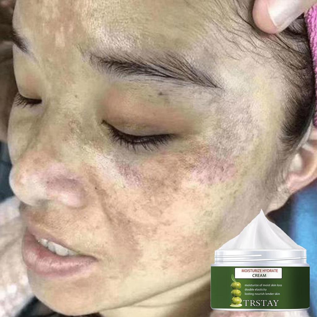 The translucent cream is gentle and non-irritating, firming the skin, brightening the complexion, reducing markings, hydrating and nourishing the skin