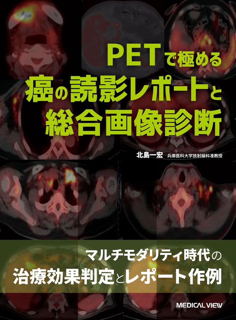 Cancer Interpretation Reports and Comprehensive Imaging Diagnosis Using PET