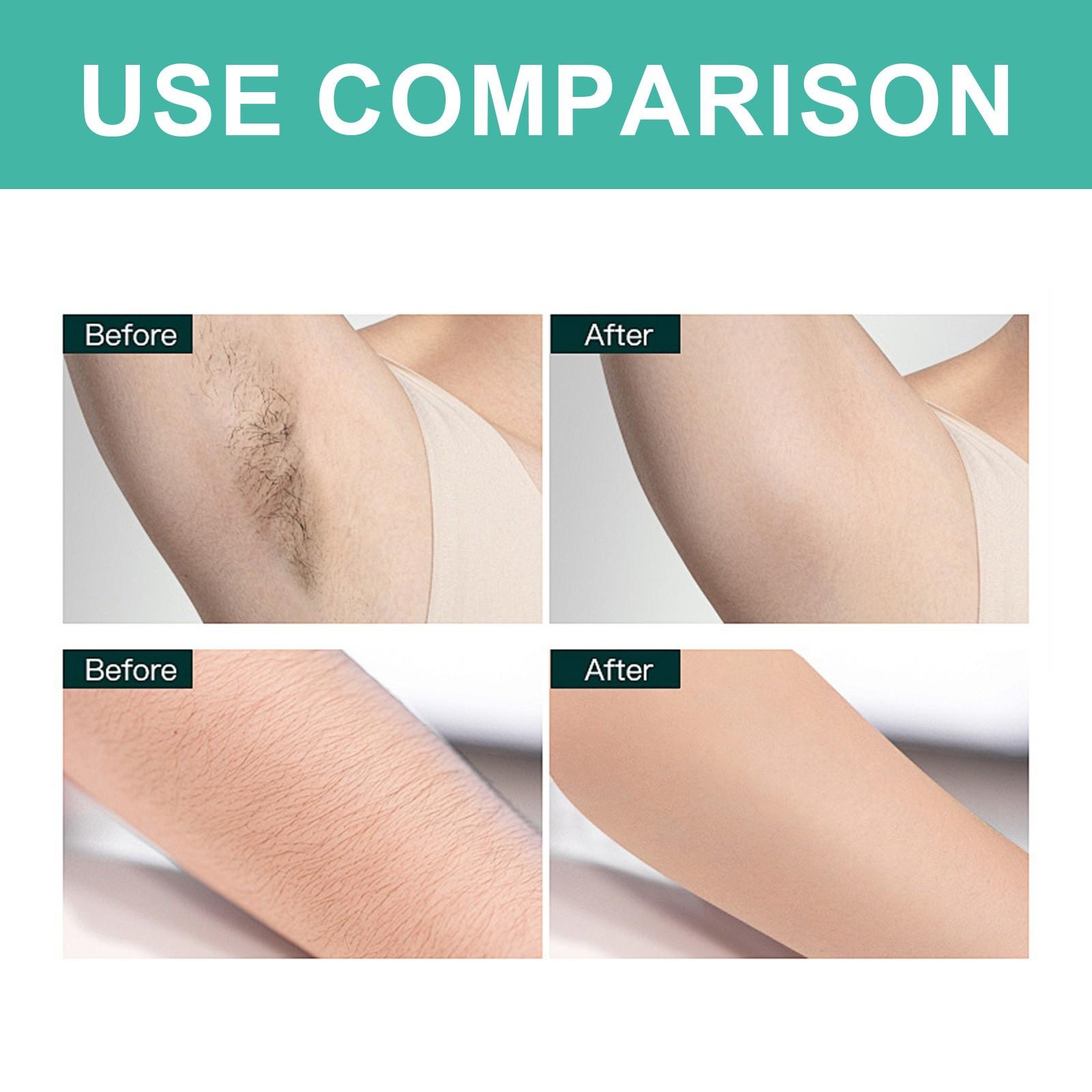 20 восковых полосок для удаления волос для летней депиляции — фото 5