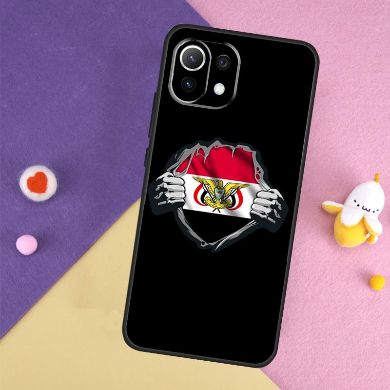 

Yemen Flag Case For Xiaomi 13T 11T 12T 14T Pro 13 14 15 Ultra POCO X7 Pro X3 X5 X6 F5 F6 M6 Pro Cover Xiaomi 14 Pro