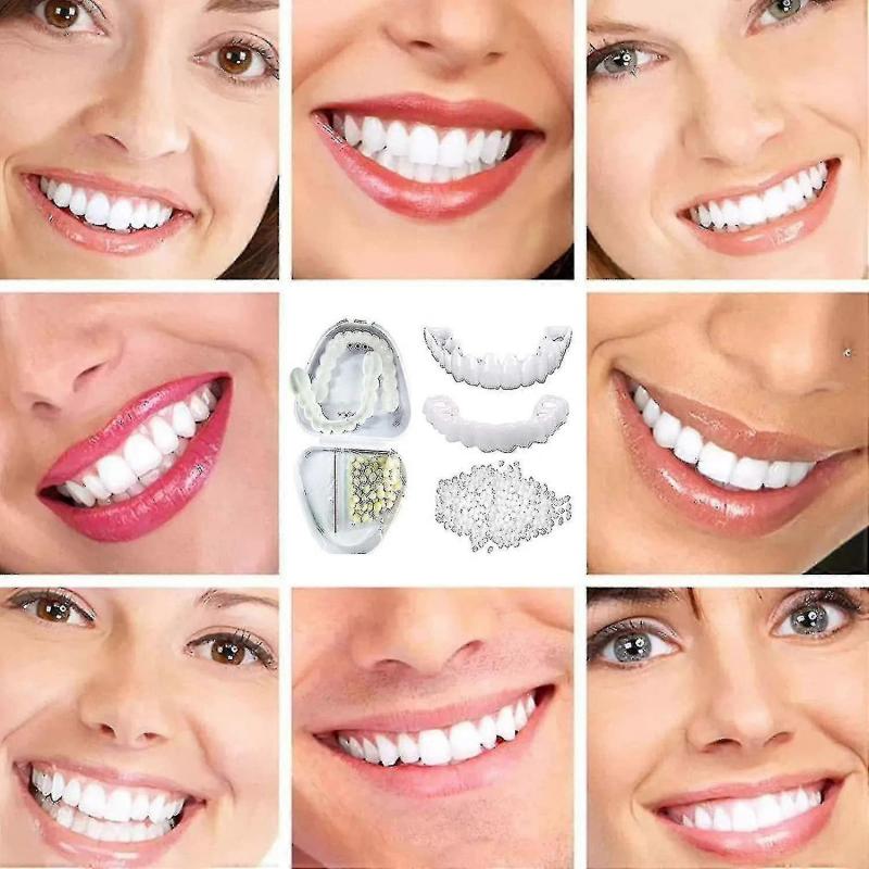 Upper & Lower Teeth Veneers - 2 Pairs Simulation Braces Sp On Veneers Smile Fake Teeth Cover Imperfect Teeth Perfect Whitening False Teeth One Size De