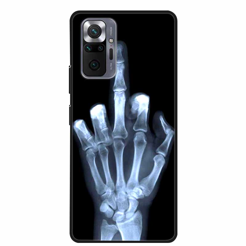 Per Xiaomi Redmi Note 10 Pro Custodia Moda Morbido Silicone Cover per Telefono per Redmi Note10 Pro Max Coque M2101K6G Paraurti Cool Funda
