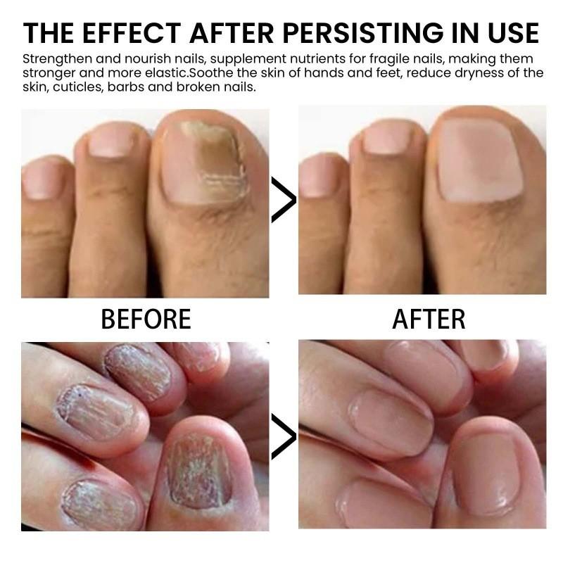 Nourishing Jaysuing Nail Repair Essence For Healthy Strong Nails 30ml