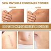 Skin Invisible Concealer Patch Skin Scar Tattoo Acne Mark Cover Patch Waterproof Skin Color Invisible Patch 60pcs