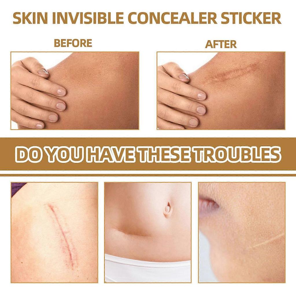 Skin Invisible Concealer Patch Skin Scar Tattoo Acne Mark Cover Patch Waterproof Skin Color Invisible Patch 60pcs
