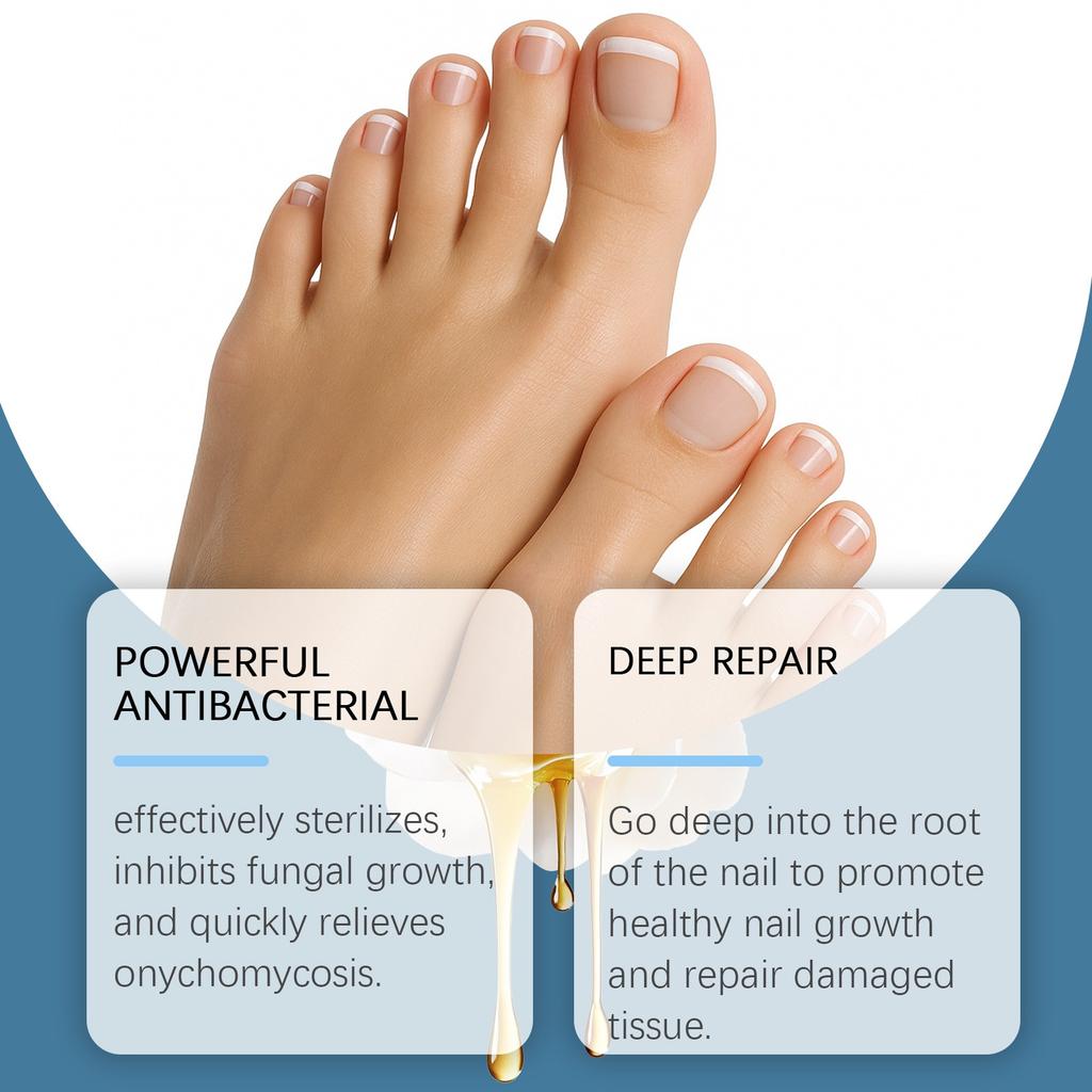 Onychomycosis Care Ointment, Nail Strengthening Cream, Nail Ointment To Strengthen Nails And Reduce Cracking