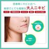 Acne Barrier Medicated Protect Adult Acne Combination Herbal Tea Facial 100g Wash, Prevention, Skin, Tree, Quasi-drug, Cleanser,