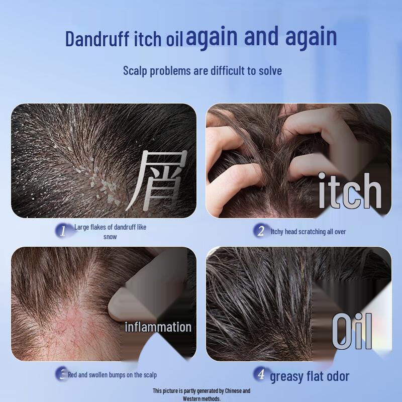 Vitas Selenium Disulfide Anti-Dandruff Shampoo