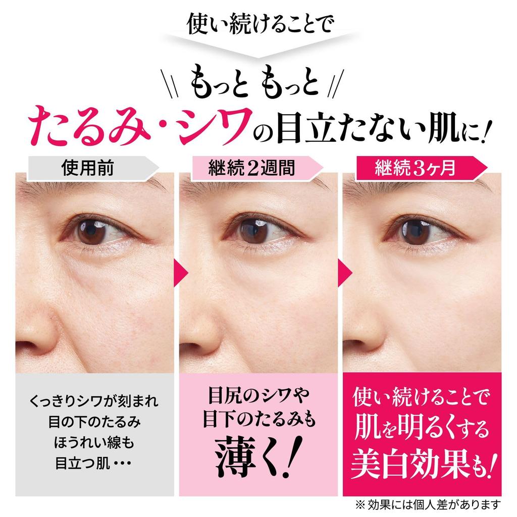 Zur Anwendung bei medizinischer Faltenverbesserung Für nasolabiale Erschlaffung unter dem zwischen dem und Faltenreparatur NA 30g [Einfach zu Hause, Creme] Falten, Augen,