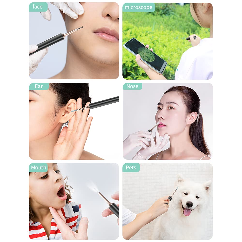 QiPower Ear Cleaning Camera Ear 5MP IP67 Ear Ear LED Smartphone WiFi Pimple Handy Compatible with Scope, High-Precision, Waterproof, Rechargeable,