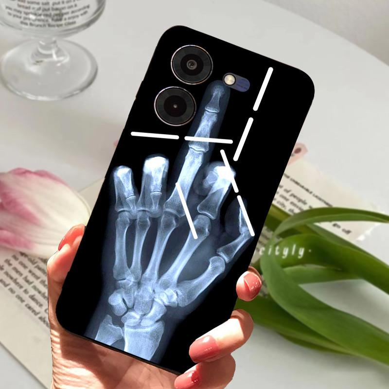 Für Tecno Pova 5 Pro 5G Hülle Pova5 4G Weiches Silikon TPU Handy Rückseite Für Tecno Pova Neo 3 Stoßfester Bumper LH6n Cartoon