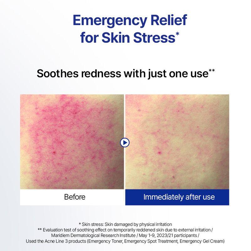 [ISOI] ACNI Dr. 1st Control Tonic 130ml