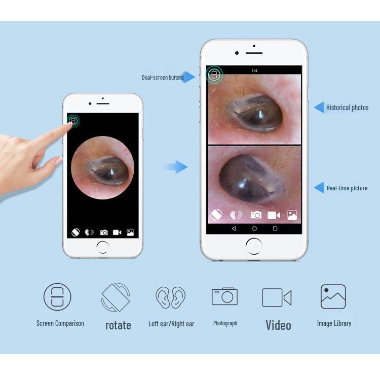 Teslong SA39W Xiaobai Portable HD WiFi Waterproof Ear Pick Otoscope