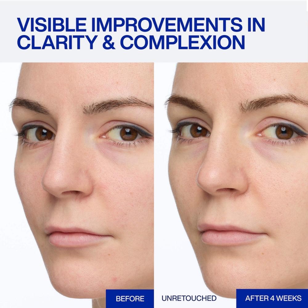 Iope Expert Sérum Antioxydant Vitamine C 25 0.77oz 23ml