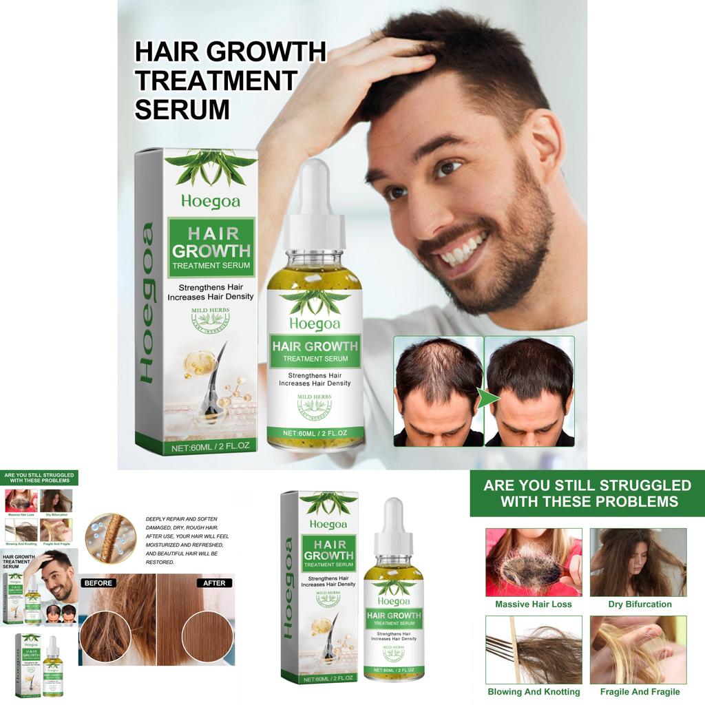 Hoegoa 60ml For Strong Resilient Hair With Natural Fragrance And Non-greasy Finish