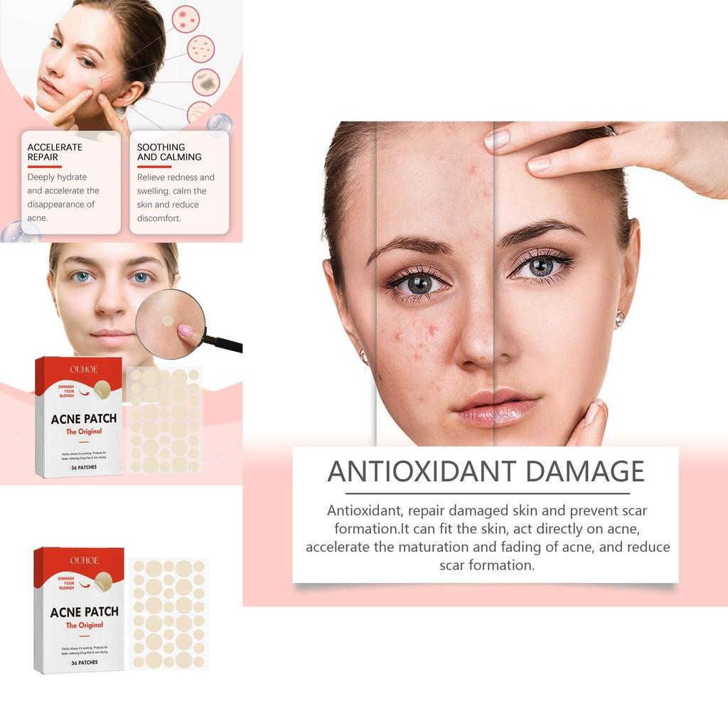Ouhoe Acne Patches For Facial Care And Support To Reduce Blemishes And Improve Skin Appearance