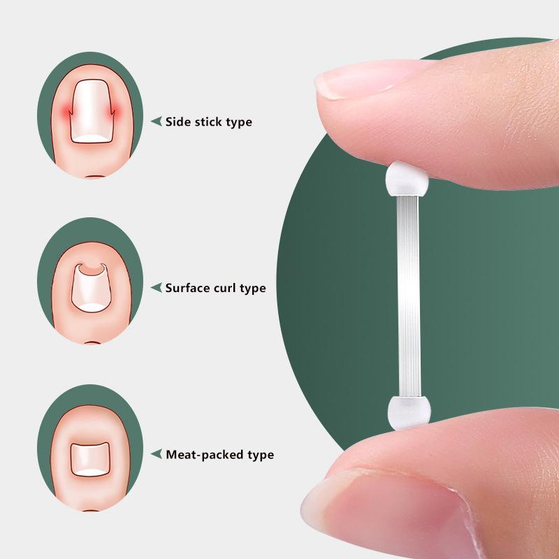 Ingrown Toenail Recover Pedicure Tool Toe Braces Toenail Straightener Toenail Fixer Bunion Corrector Ingrown Toenails Corrector