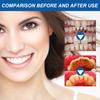 Hyaluronic Acid Gum Repair Care Gel Relieve Sore Gums Allergy Deep Cleaning Teeth Stains Tartar Serum Dental Caries Toothpaste