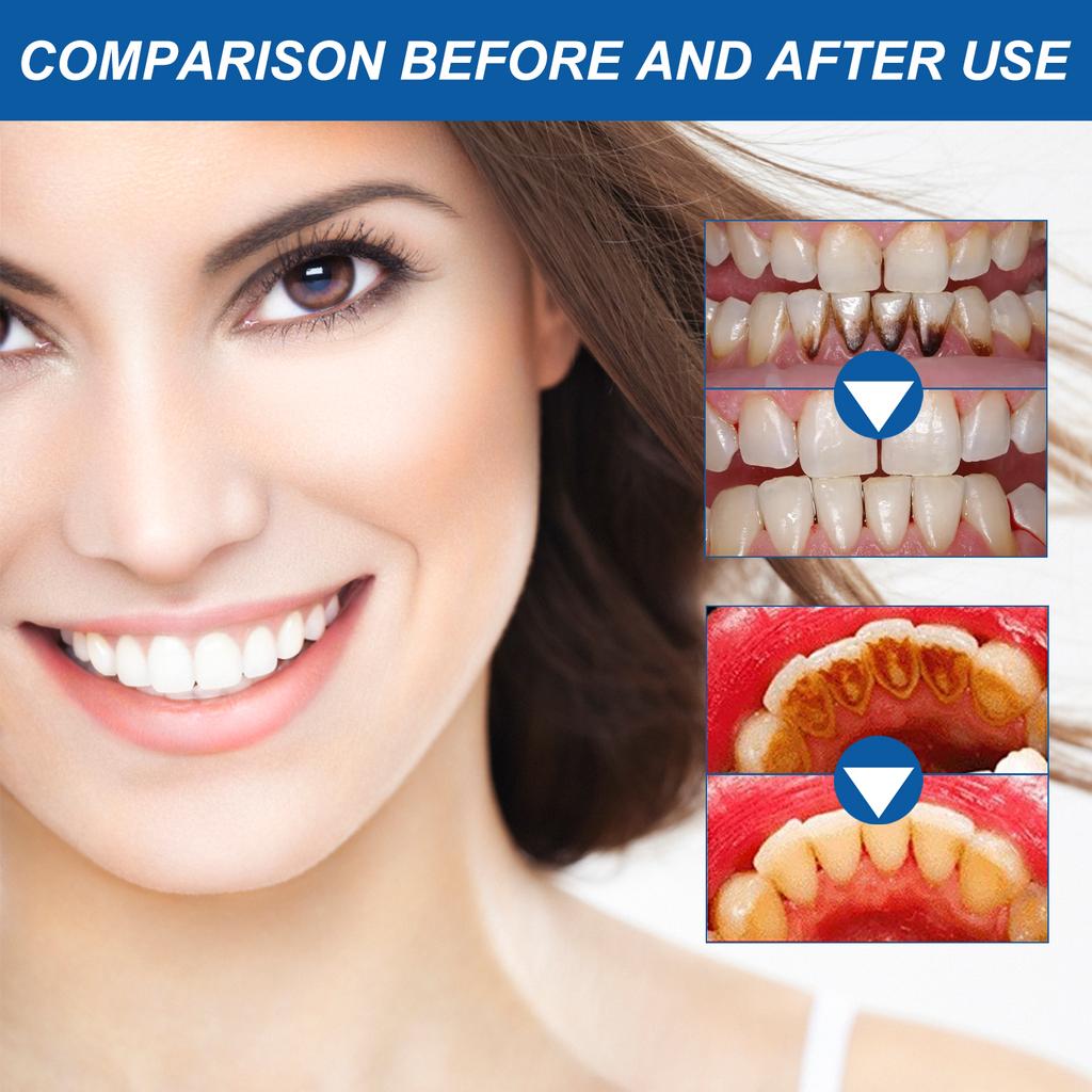 Hyaluronic Acid Gum Repair Care Gel Relieve Sore Gums Allergy Deep Cleaning Teeth Stains Tartar Serum Dental Caries Toothpaste