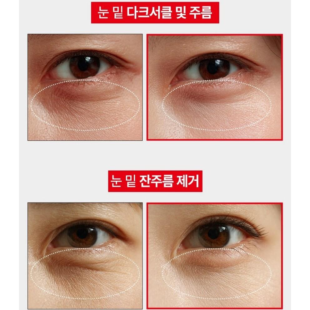 [Victonine] ExoSome Eye Cream, Lifting Peptide, Under Eye Fat Wrinkle Improvement, 40ml