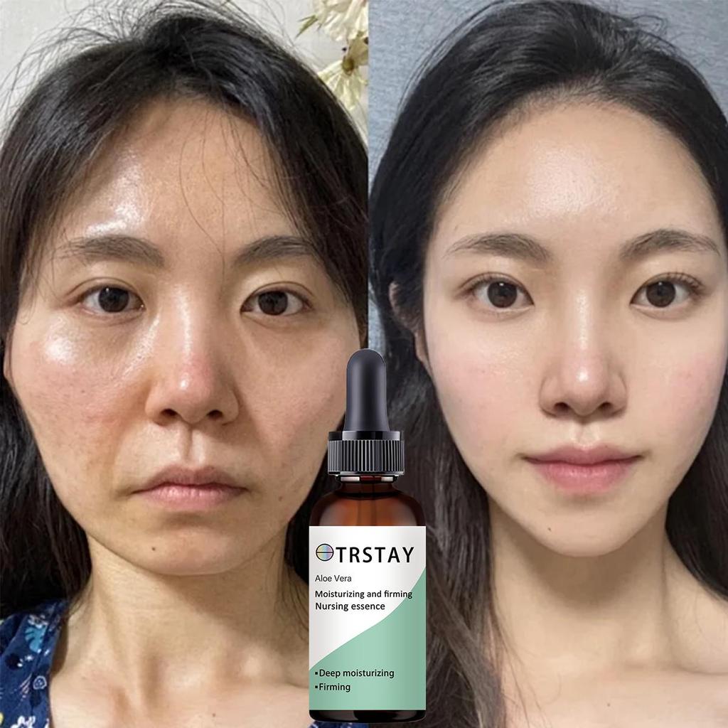 Vitamin C Essence Fade Fine Lines Women's Facial Essence Anti-aging Facial Essence Acne Women's Facial Essence