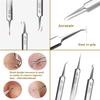 1/3/6/8PCS Stainless Steel Acne Clip Blackhead Remover Tweezer Pimple Extractor Acne Needle Facial Beauty Salon Skin Care Tools
