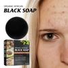 Gentle Facial Cleansing, Back Acne Care, Skin Bath Soap