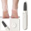 Exfoliating Electric Callus Remover Adjustable Foot Grinder Electric Foot File  Home Use