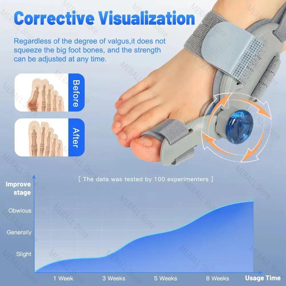 Adjustable Hallux Valgus Big Toe Corrector Orthopedic Bunion Corrector Device Foot Pain Relief Splint Toe Orthopedic Supplies