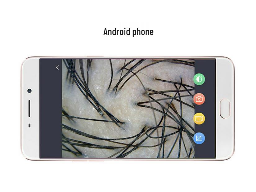 JHOT Wireless Hair & Scalp Analyzer – Hair Follicle Tester for Growth Clinics