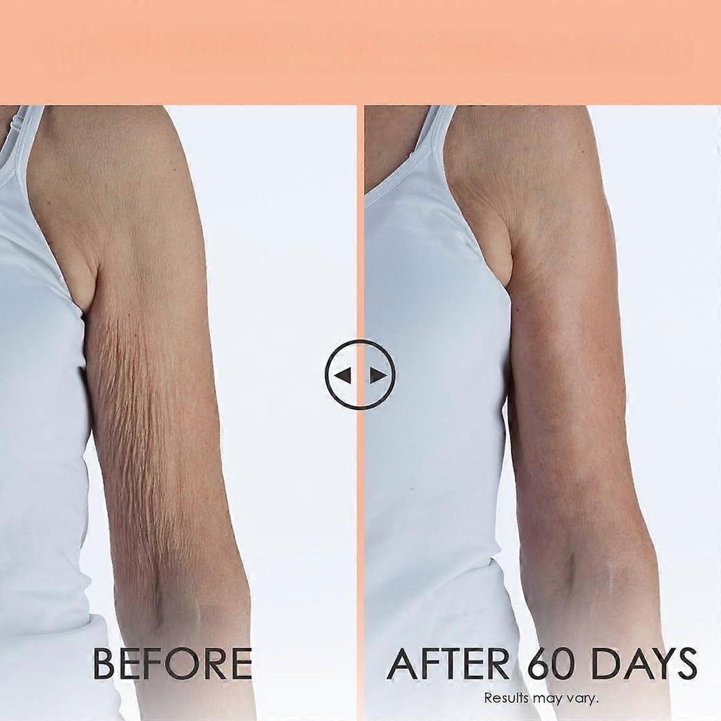 Crepe Erase Advanced Körperpflegebehandlung, Anti-Aging Faltencreme, Unterstützt die natürliche Elastin- & Kollagenproduktion der Haut - Feuchtigkeitsspendend, Körperstraffende Creme,