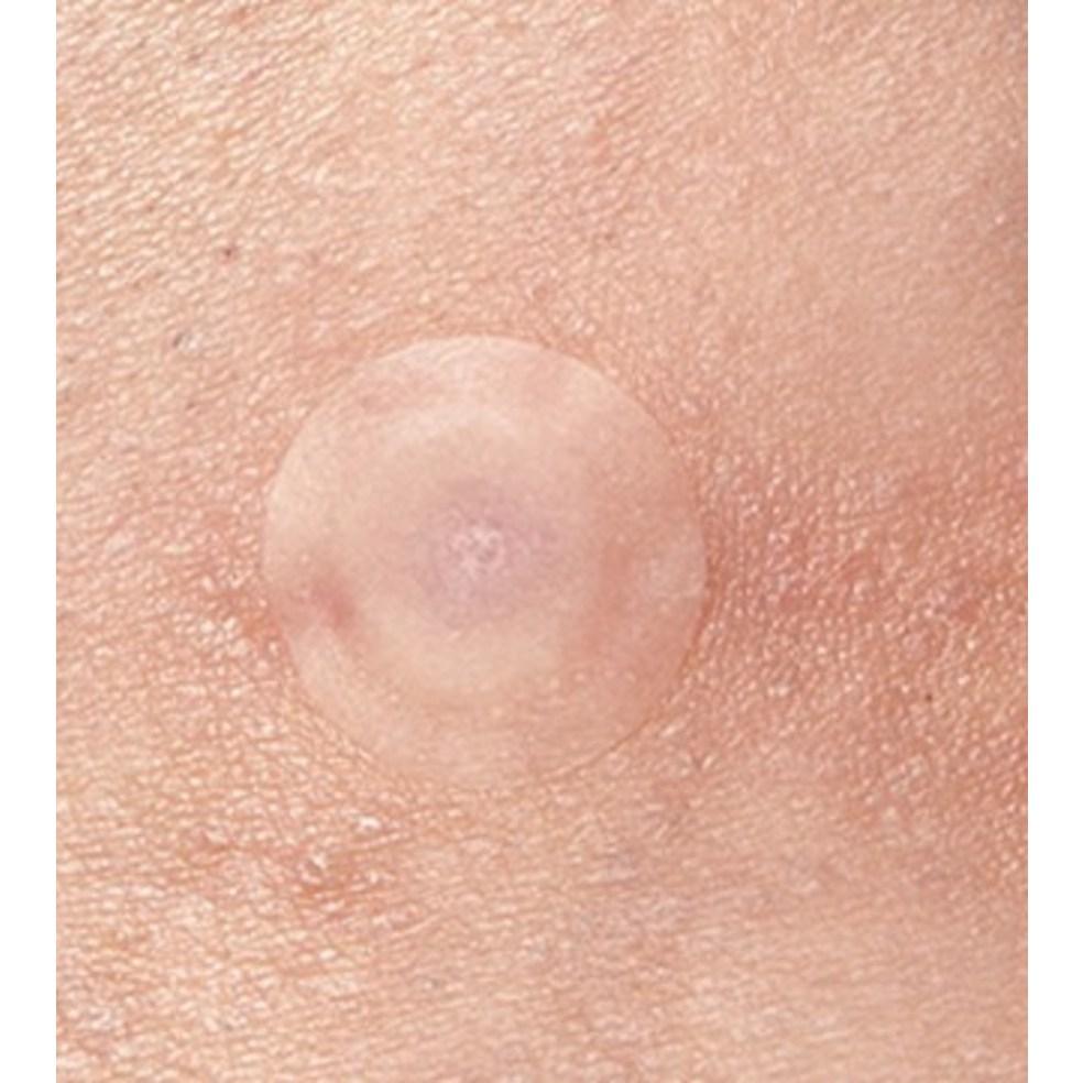 MEDI-PEEL Phyto Cicanol B5 Spot Patch S (12 Patches × 2 Packs)