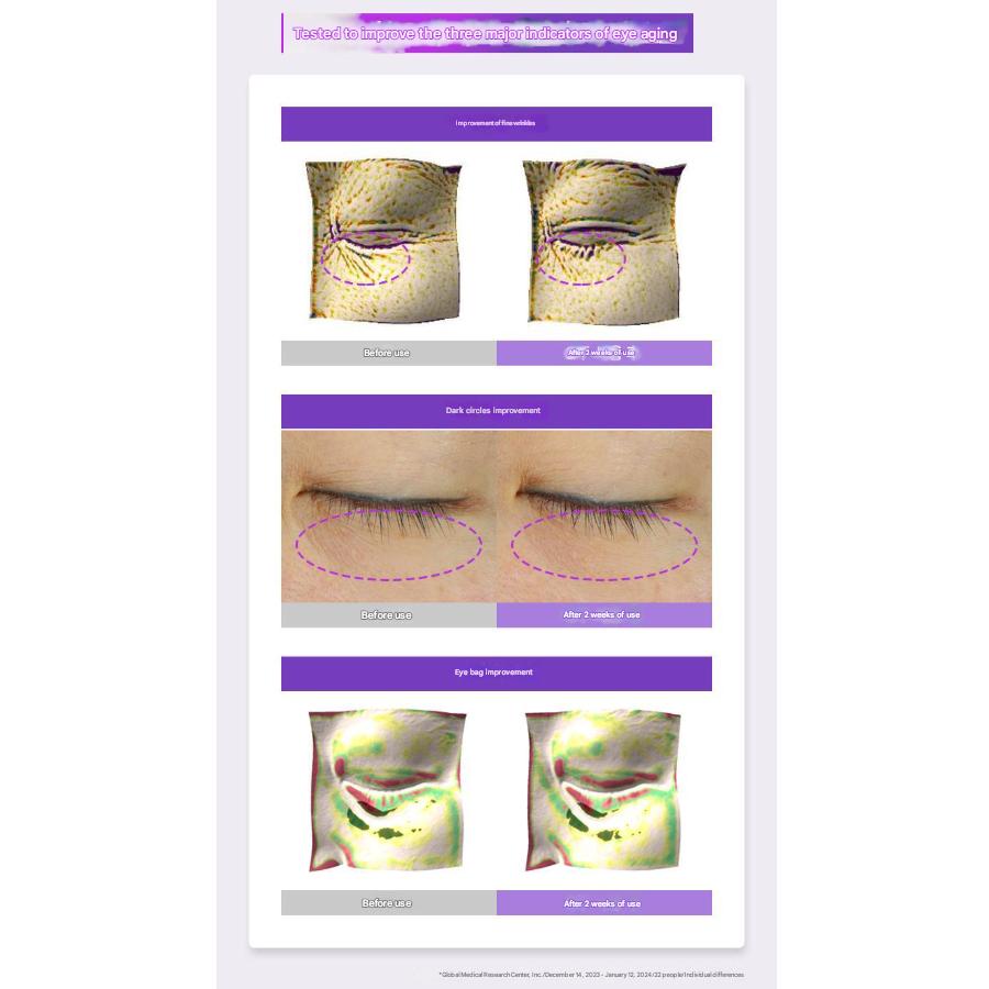 BIOHEAL BOH Probioderm™ 3D Lifting Eye & Wrinkle Cream 25ml (3 Options)