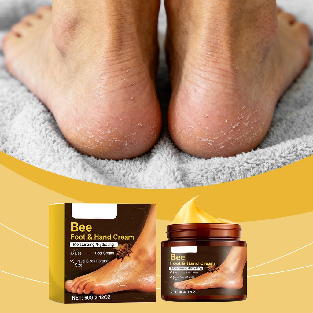 Foot Care Cream, Reducing Chapped, Painful And Uncomfortable Feet And Hands, Nourishing Care Cream, 60g