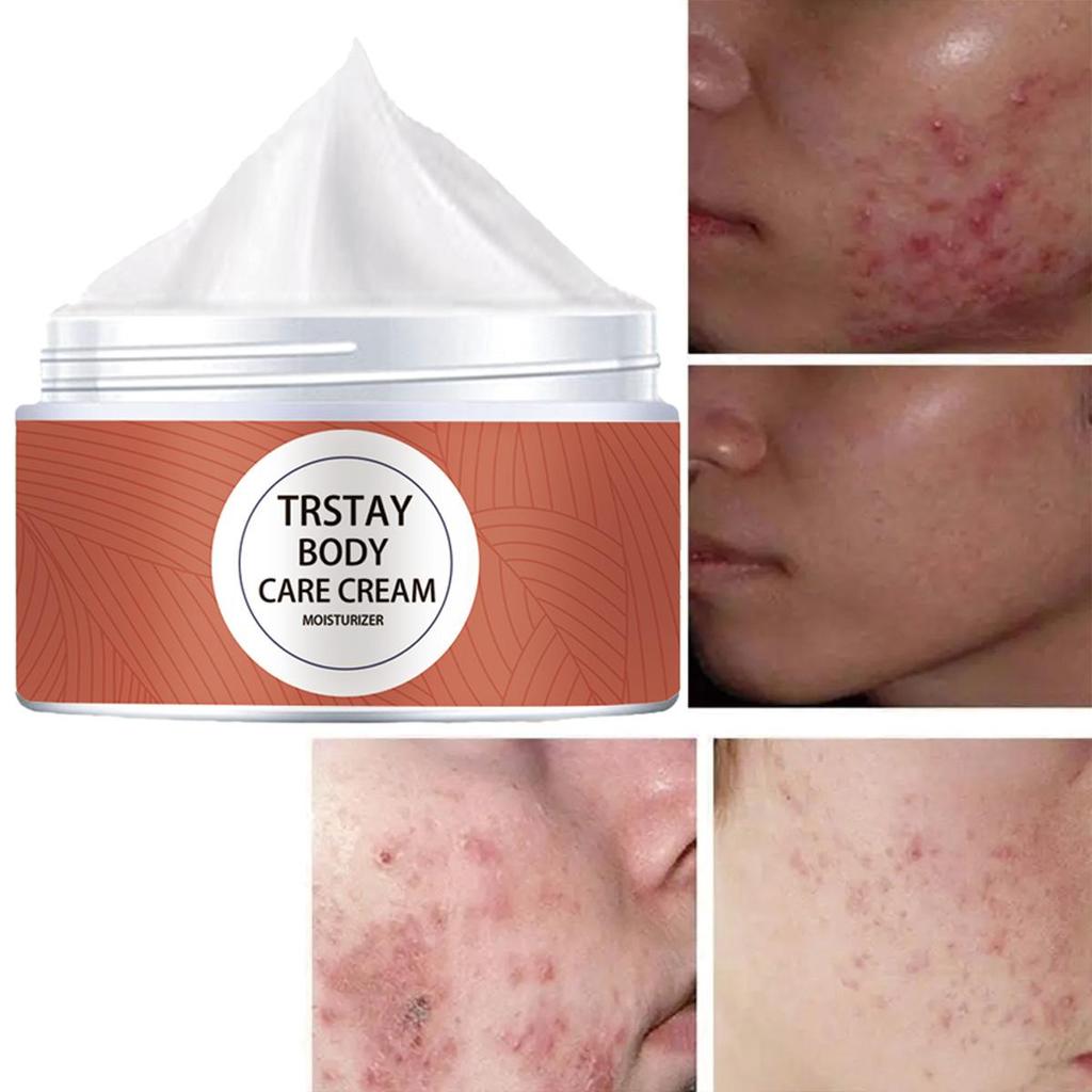 Moisturizing Cream That Brightens and Smooths the Skin, Balances the Skin's Radiance, Rejuvenates the Skin, and Deeply Replenishes the Skin's Moisture