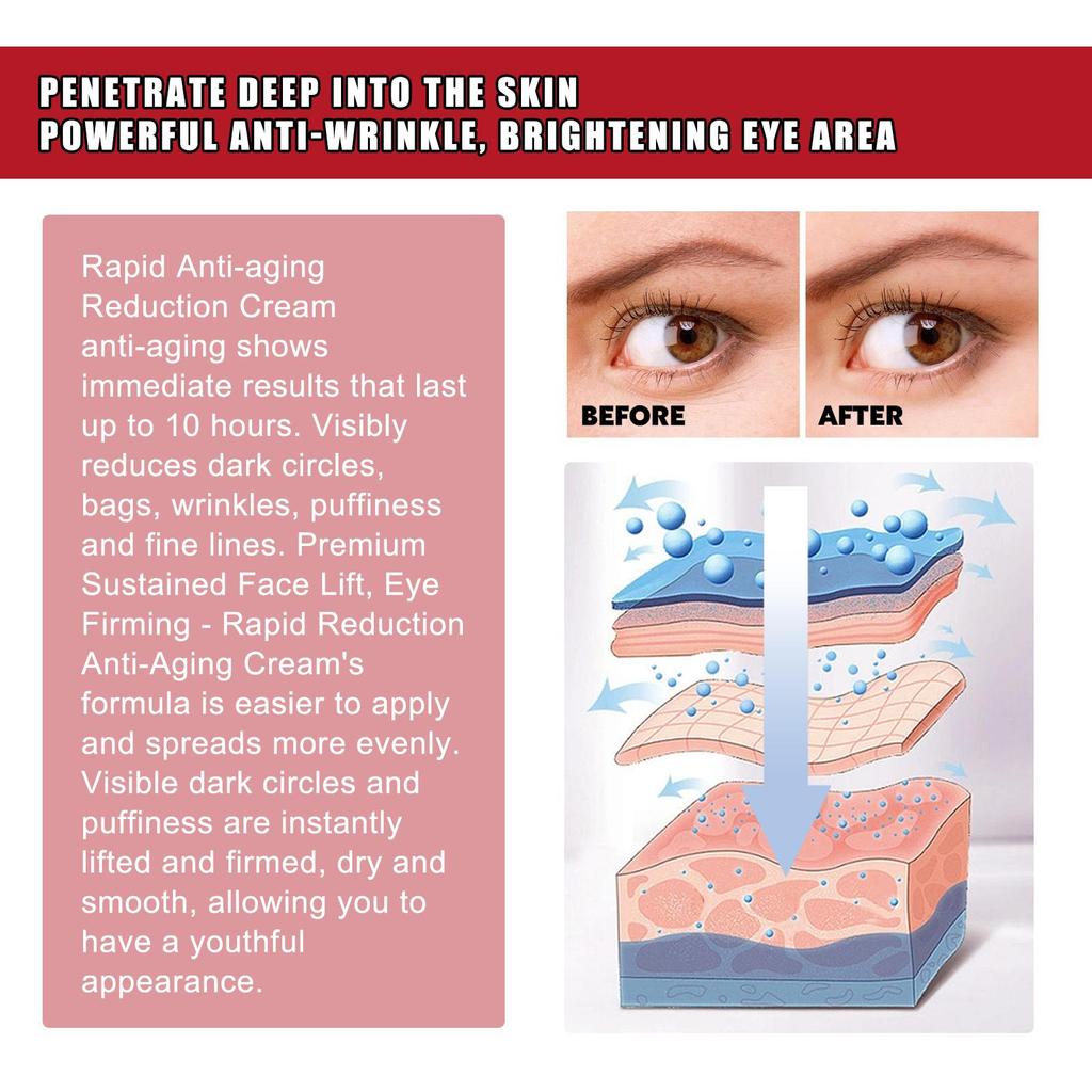 West&Month Propolis Anti-Wrinkle Eye Cream, Moisturizes Eyes, Reduces Fine Lines and Dark Spots, Firms and Brightens, Removes Milia 30g