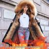 Women's Fur Detachable Shearling Winter Parka - Plus Size Warm Thick Down Jacket