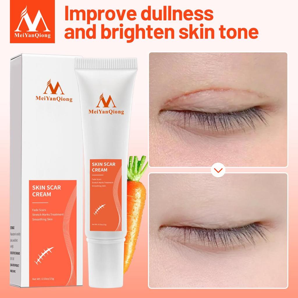 Acne Removal Cream Skin Repair Face Cream Acne Spots Acne Blackhead Whitening Cream