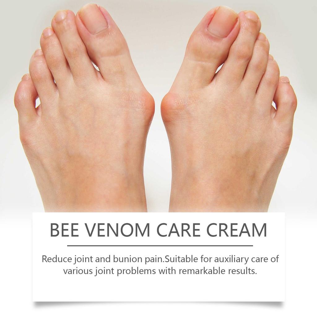 South Moon Bee Venom Care Cream For Correcting Swollen Feet And Joint Discomfort
