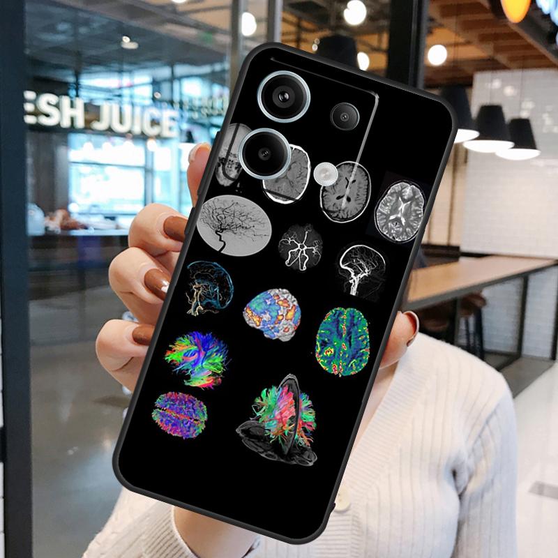 Anatomia Mózg Etui Dla Xiaomi Redmi Note 11 9 10 12 13 14 15 Pro Plus Redmi 15 15C 10C 12C 13C 14C Pokrowiec