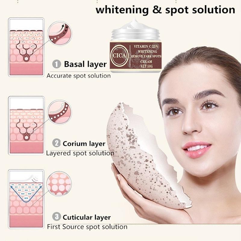 Women New Skin Brightening Cream&Freckle Cream&Dark Spot Corrector Remover for Face & Melasma Blemishes