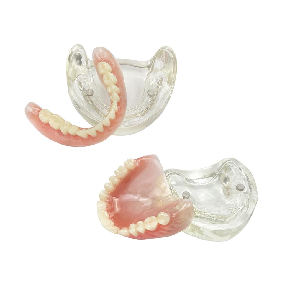 Modelo de Implante Dental 2 Implante Prótesis Completa Superior Inferior Modelo de Dientes Typodont Productos de Odontología Para Enseñanza Estudio