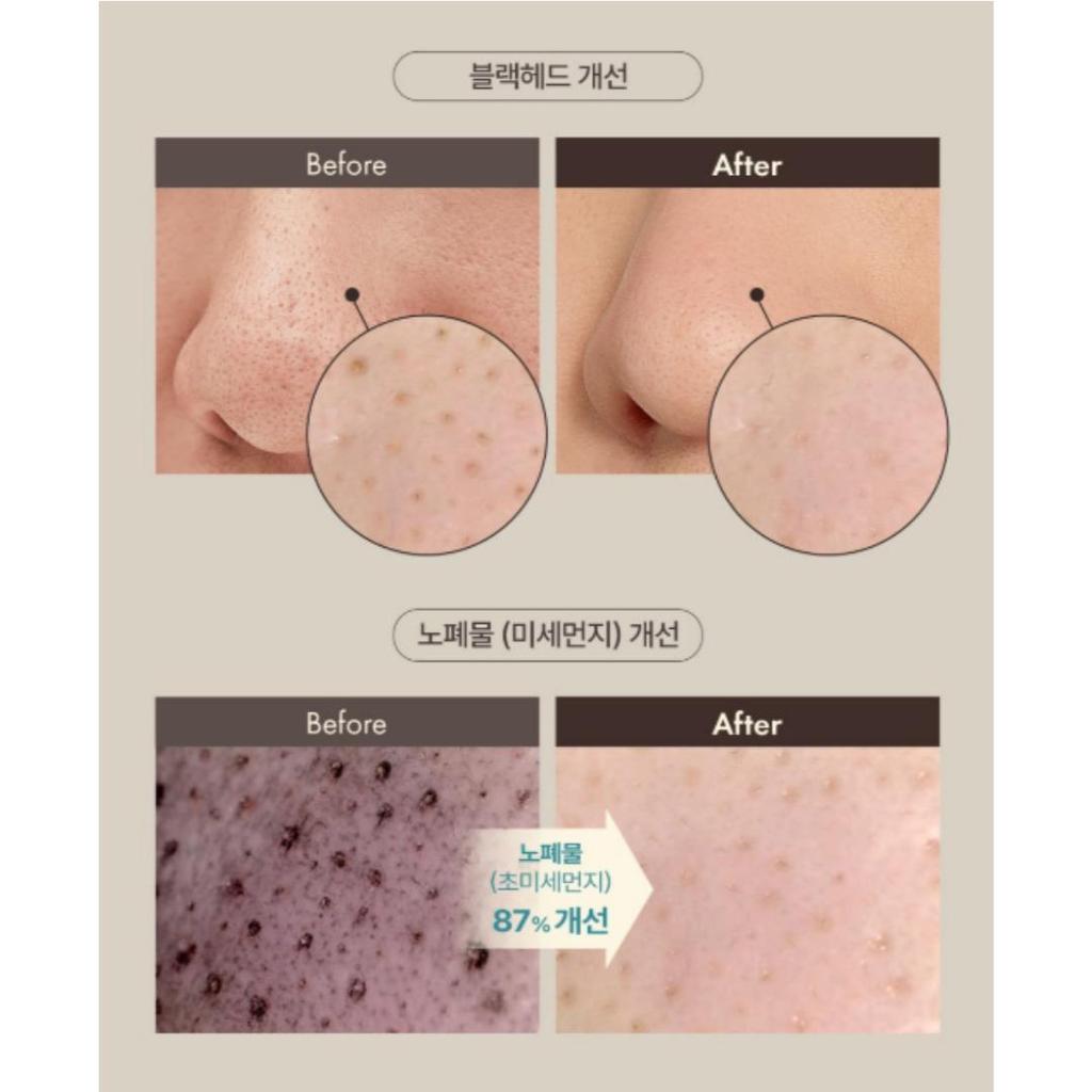 [OBgE] Blackhead Scrub Balm 20g