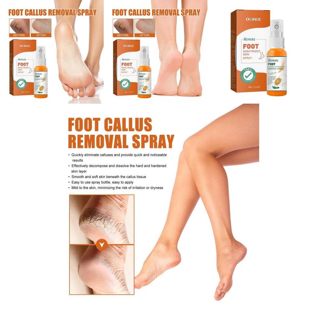 Nourishing Ouhoe Foot Spray For Softening Calluses And Cracked Heels 30ml
