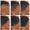 New Fast Hair Growth Serum African Crazy Regrowth Traction Alopecia Hair Loss Prevent Edges Bald