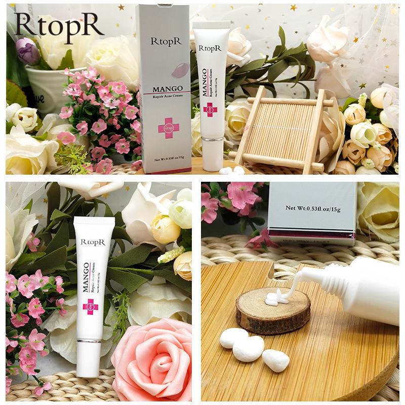 rtopr mango acne cream