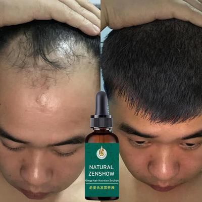 Hair Growth Treatment Essence Hair Serum Ginger Essential Anti Hair Loss Essence