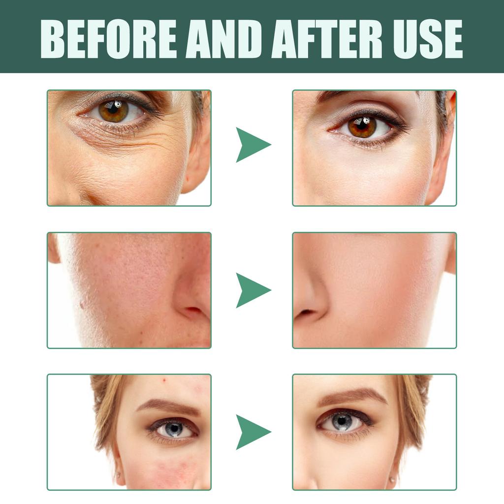 New Advanced Deep Skin Care, Facial Skin Daily Lotion, Face Lotion, Pore Lift Face Lotion For All Skin Types 30ml