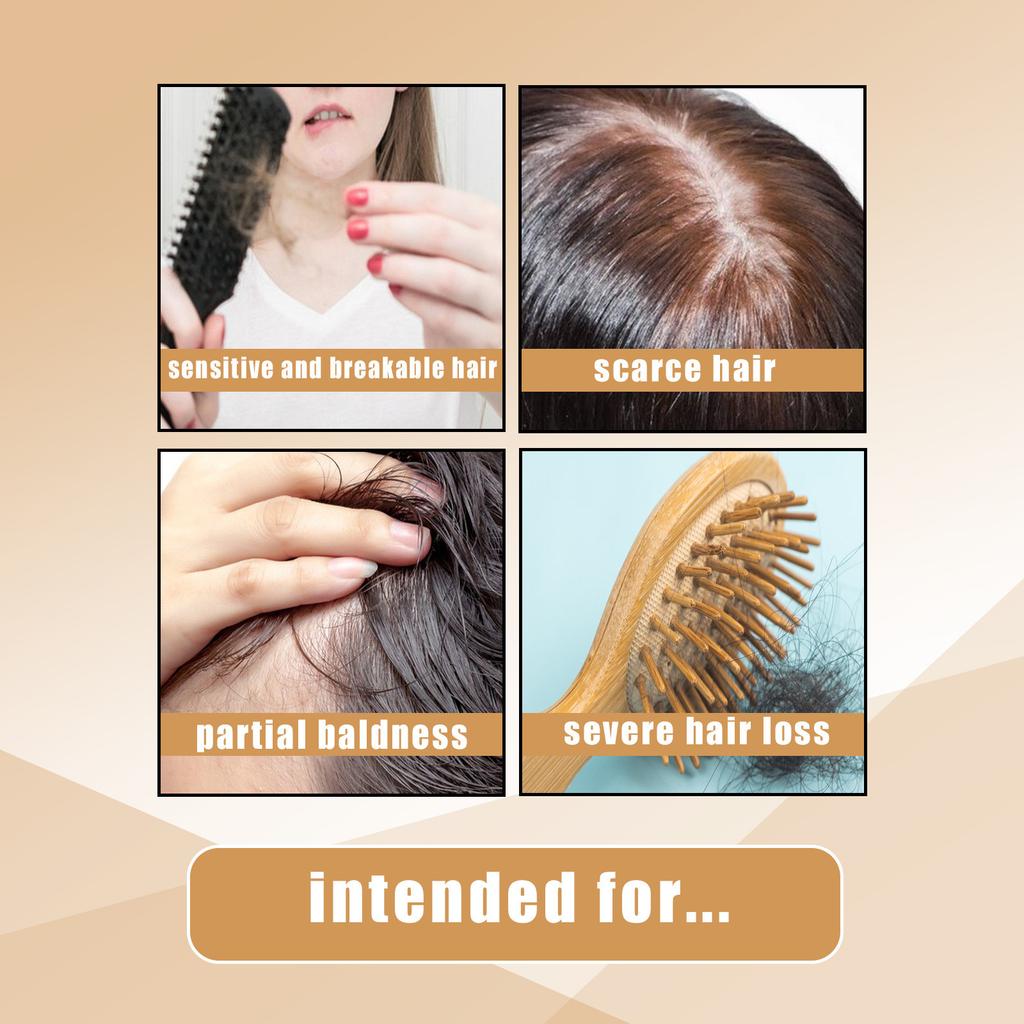 Shampoo Soap, Refreshing Anti-dandruff, Oil-free Care, Smoothing Hair, Nourishing Scalp, Shampoo Soap For All Hair Types