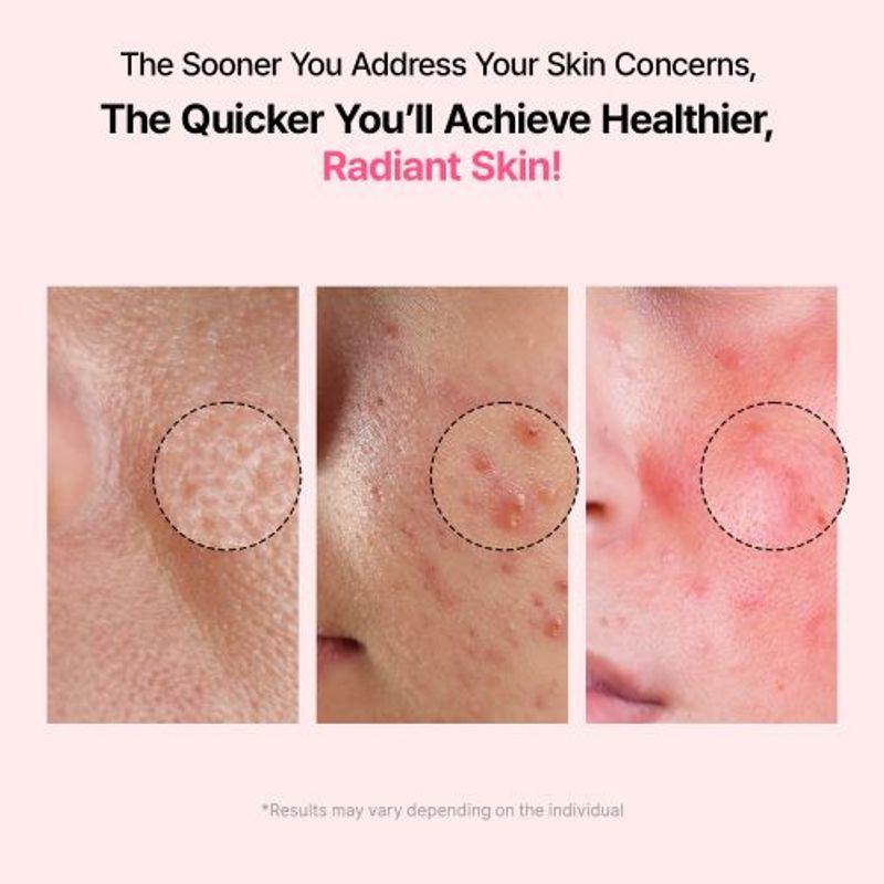 [Veganifect] Lifting And Balancing Fig Chestnut Pore Tight Ampoule 50ml